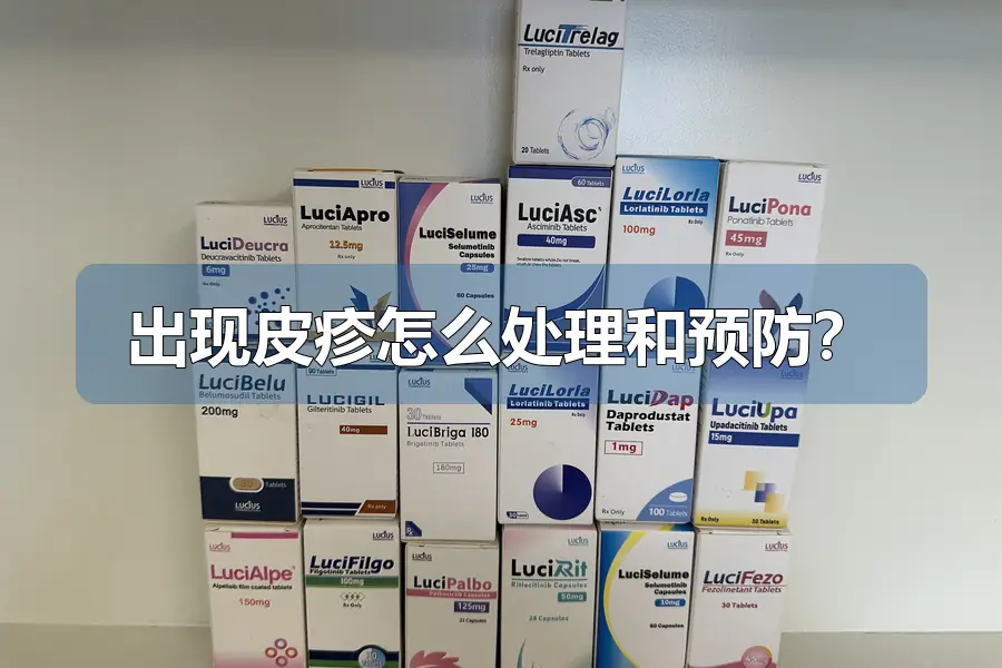 出现皮疹怎么处理和预防？