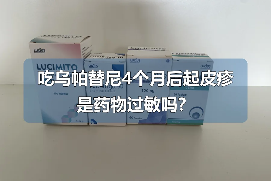 吃乌帕替尼4个月后起皮疹是药物过敏吗？